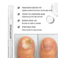 ✨Neuheiten🔥Feder zur Behandlung von Nagelpilz bei beschädigten Nägeln