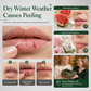 🎄 50% Rabatt! ✨Weihnachts-Lippenpflegeset – Feuchtigkeit & Pflege, ideal als Geschenk🎁
